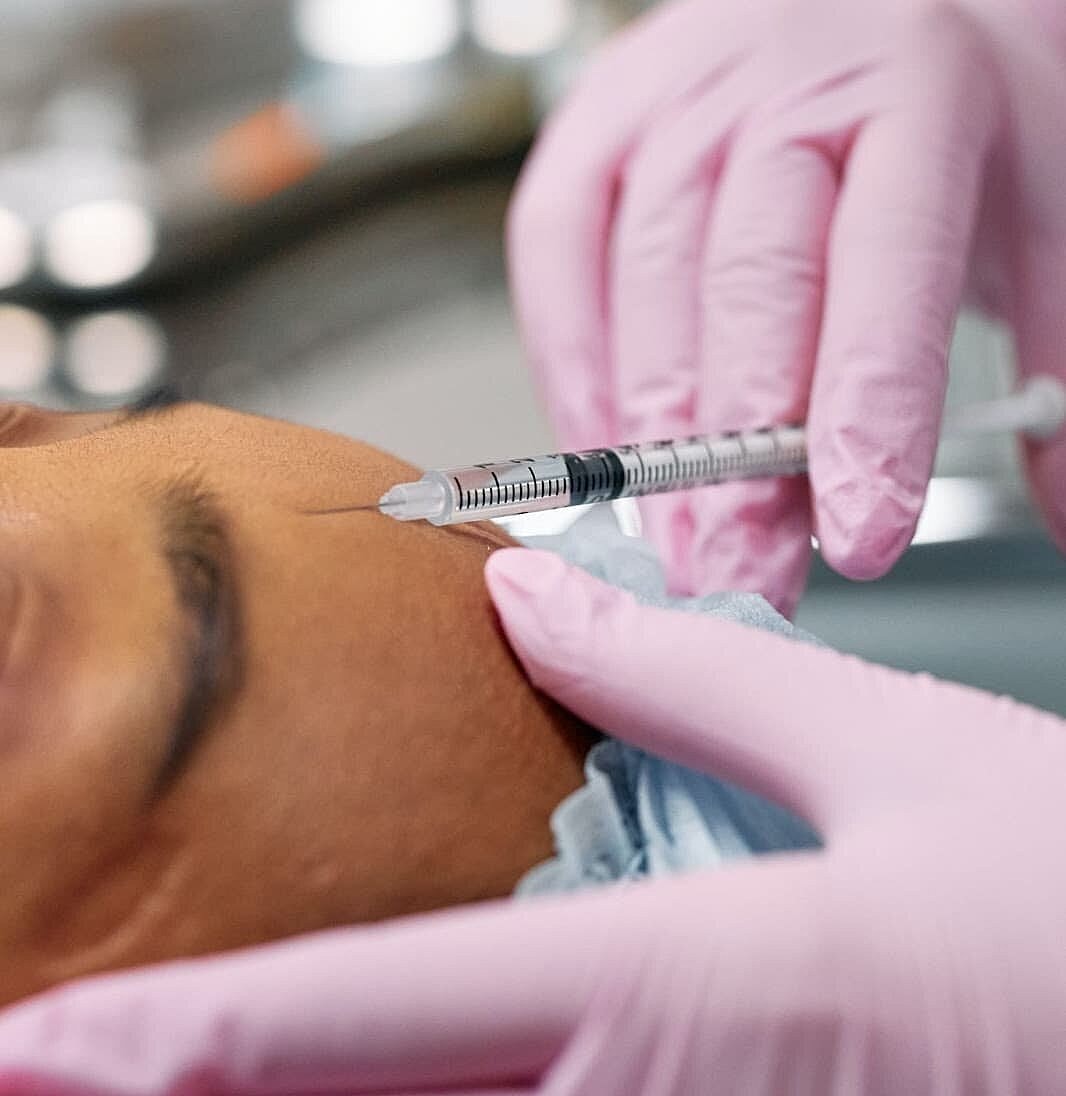 Injection procedure on a patient's forehead.
