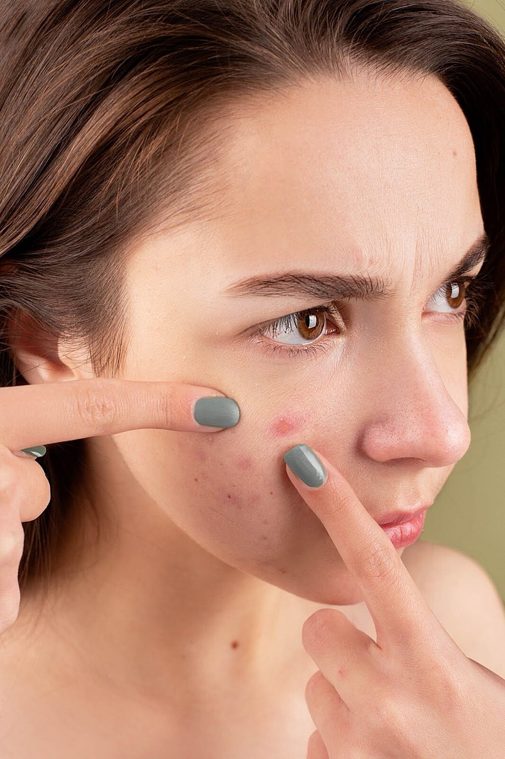 Young woman examining her acne with concern.